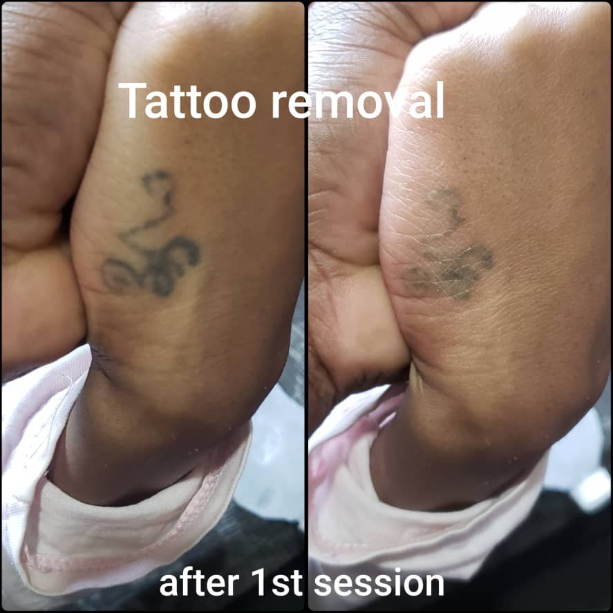 picture of tattoo